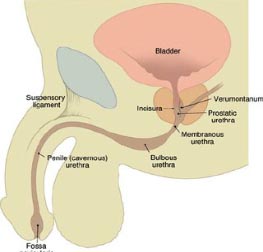 دریچه مجرای خلفی (Posterior Urethral Valve)
